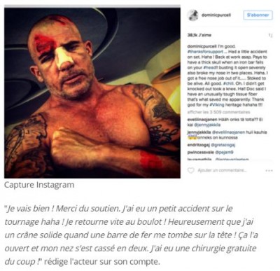 Prison Break - Dominic Purcell défiguré après un violent accident sur le tournage.jpg